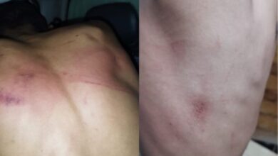 Foto de Vítima de “salve” aciona a Polícia e membro de facção é preso após tortura